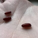 Ne touchez surtout pas à cela si vous en voyez sur vos plantes