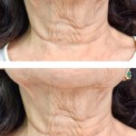 La cartographie du visage : ce que votre peau dévoile sur votre état de santé